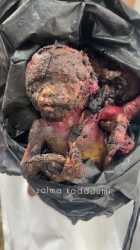 burnt fetus_thumb.jpg