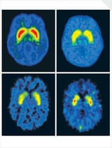 60e3ef11f174020d0605b02c_brain-scans1