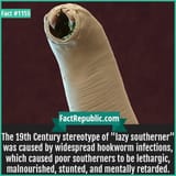 1155.-Hookworm-Lazy-Southerners