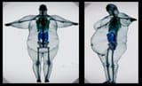 obese xray