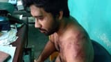 _119247147_dr.senapatiinjuries3