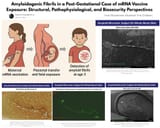 mRNA-PostGestationalAmyloid