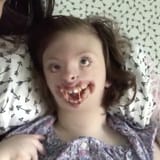 pigskin deformed kid8