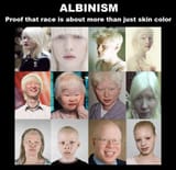 Albino races