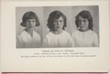 THREE QUADROON SISTERS FatherHalfblood first cross MotherAustralian White The large freckles the face the centre f