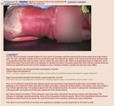1705955714728497