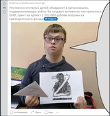 down syndrome