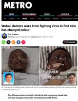 black chinks