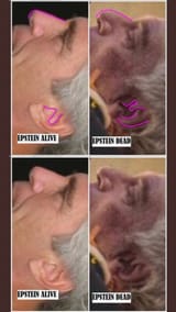 epstein