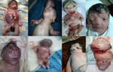 depleted uranium Iraq