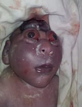 depleted uranium iraq