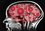 SARS-CoV-2-Brain-1217077007