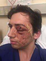 0_PAY-UK-Prosthetic-Eye-Attack