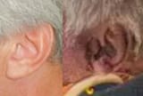 real v fake epstein ear_121032