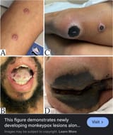 1723778238303966