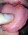 181752_thumb.jpg