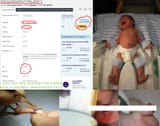 buyforeskinfor$431