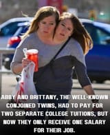 conjoined twins college