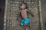 yemenhunger3
