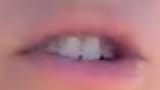 rat teeth