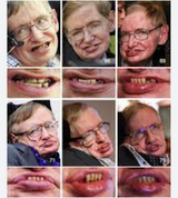 Screenshot 2025-07-09 at 13-51-07 hawking&#039;s teeth - Google Search