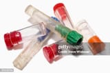 vials-for-crack-cocaine-rock-used-to-freebase