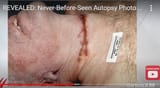 Epstein Autopsy Not Sheet