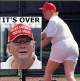 Cellulite ass