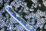 GMO parasite in jew jab