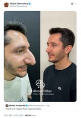 jutku shekel nose