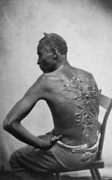 Scourged_back_by_McPherson_&amp;_Oliver,_1863,_retouched
