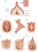 468807_1_En_9_Fig1_HTML