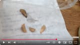 Screenshot 2025-07-11 at 14-07-35 (29) Botfly Maggot Removal - YouTube