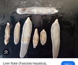 Screenshot 2025-07-11 at 14-24-29 liver fluke - Google Search