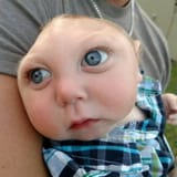 jewish-vaxx-microcephaly
