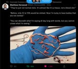vaccineclots8