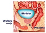 Diagram_of_a_prostate-2417308626