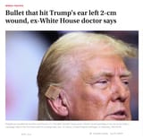 Screenshot 2025-07-13 at 07-55-29 Bullet that hit Trump&#039;s ear left 2-cm wound ex-White House doctor says - The Japan Times