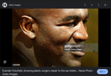 Screenshot 2025-07-13 at 09-54-30 evander holyfield ear - Google Search