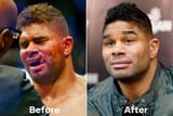 Overeem-skilled-surgeon