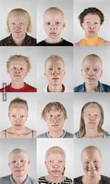 group-albino-sub-saharan-080