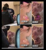 epstein ear compare