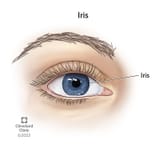 iris