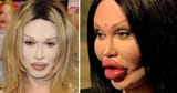 Pete Burns