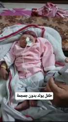 palestinian baby euthanized_thumb.jpg