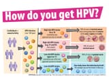 sept-10-2016-hpv