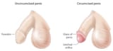 dickskin