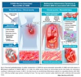 COVID-19 vaccine-associated myocarditis