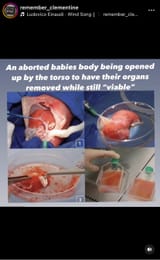 fetal-research1723864489304828