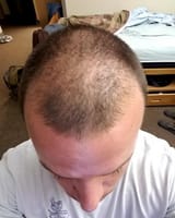 bald